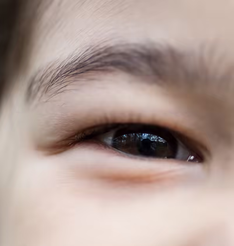Closeup of Scarlett’s Eye